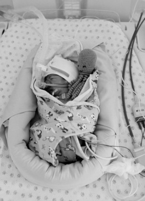 perfusion